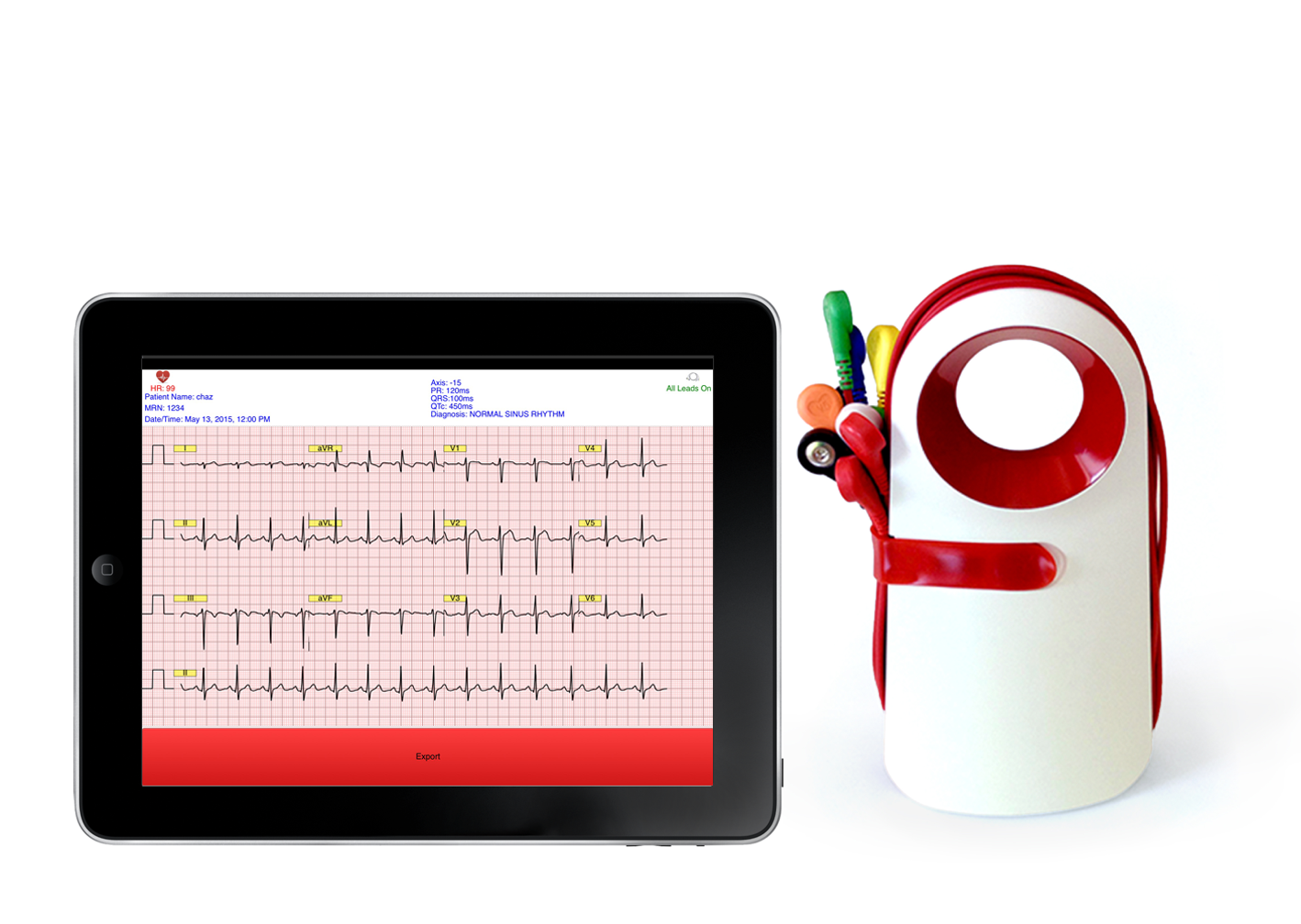 Triomi 12-lead EKG device paired with a tablet display